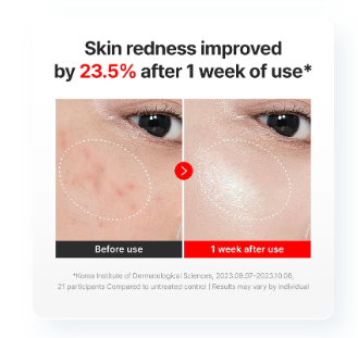 Centellian24 Madeca Cream Time Reverse (50ml)
