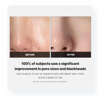 Medicube Zero Pore Pad 2.0 (70ea)
